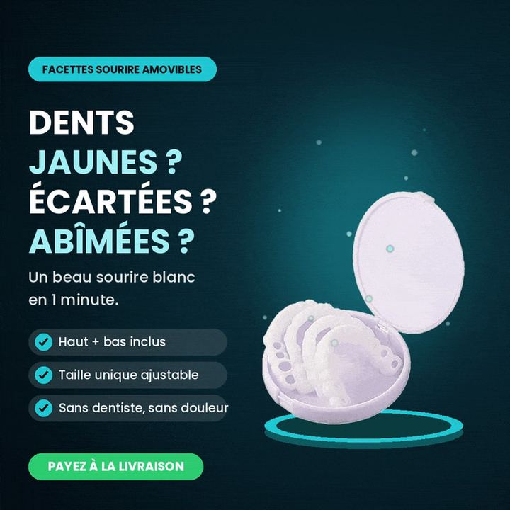 Facette dentaire — miniature 2