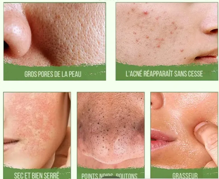 GREEN MASK STICK — miniature 3