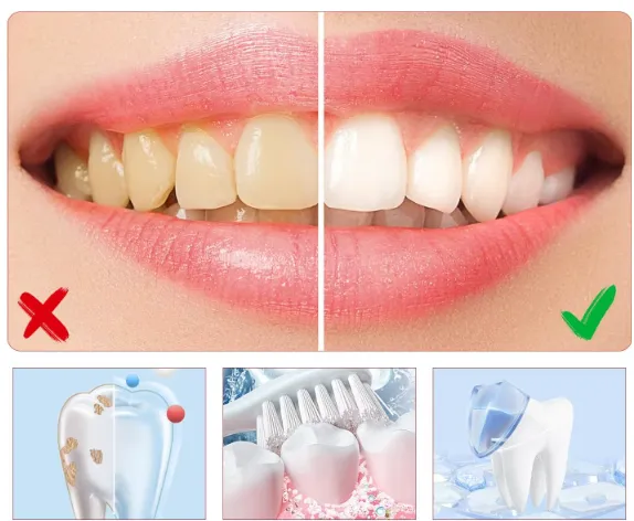 Blanchisseur de dents — miniature 2