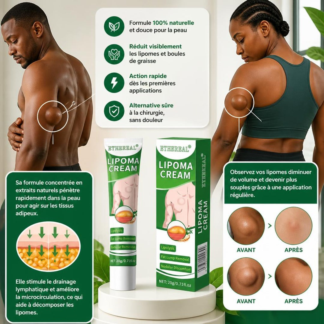 Lipoma Cream Original – Soin anti-lipomes — miniature 2