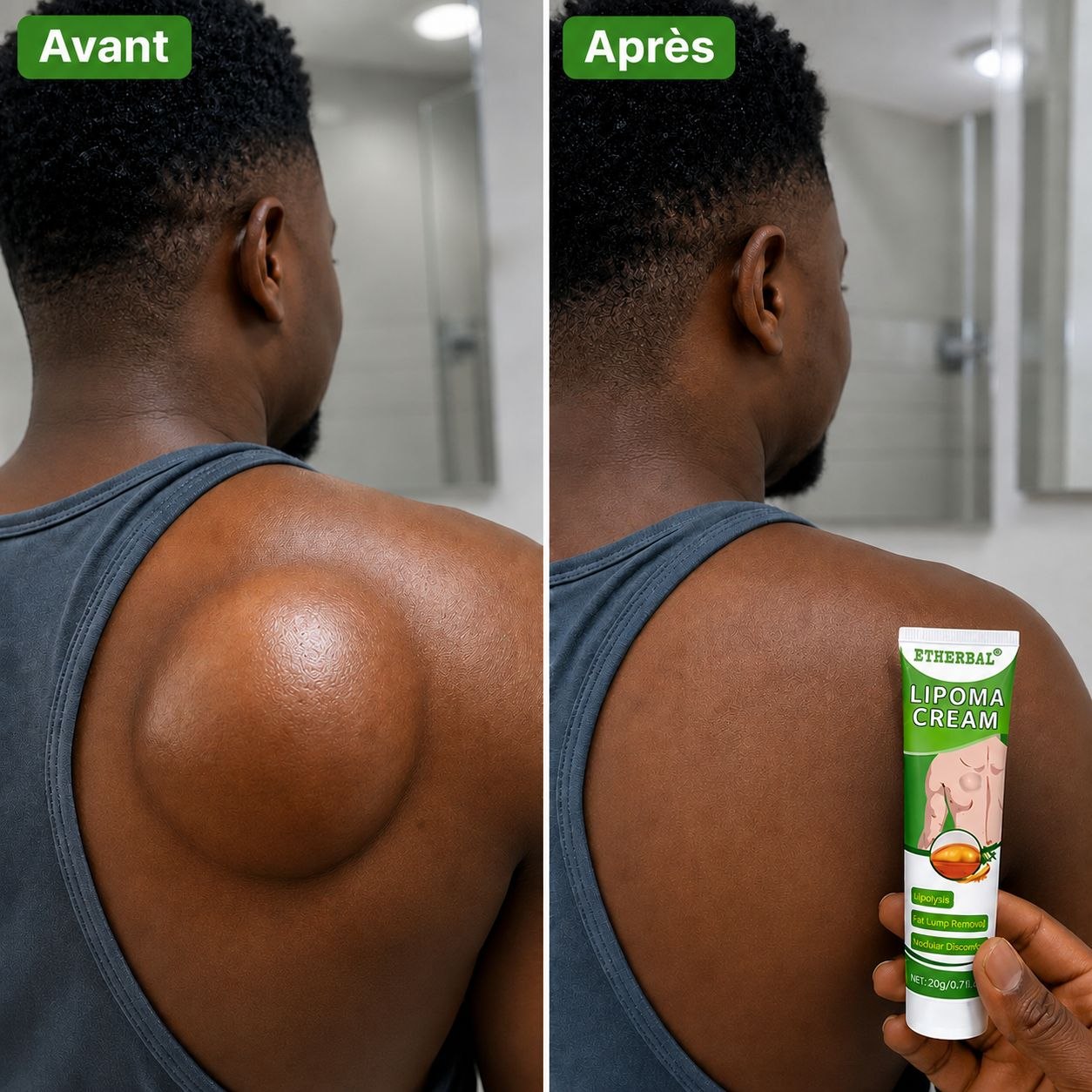 Lipoma Cream Original – Soin anti-lipomes — vue 1