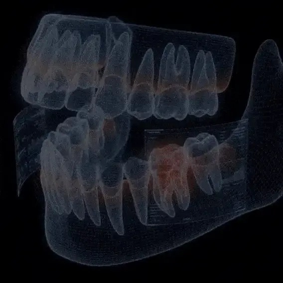 Illustration 3D des dents et des gencives